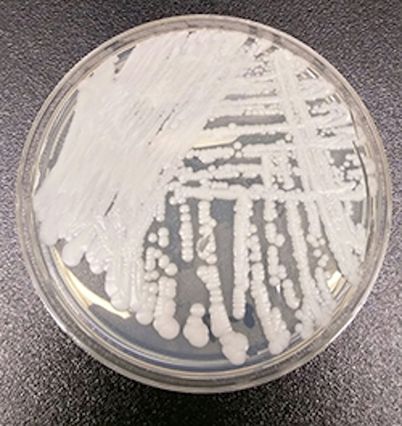 C. auris, a fungus resistant to many medications, cultured in a petri dish at a CDC laboratory.